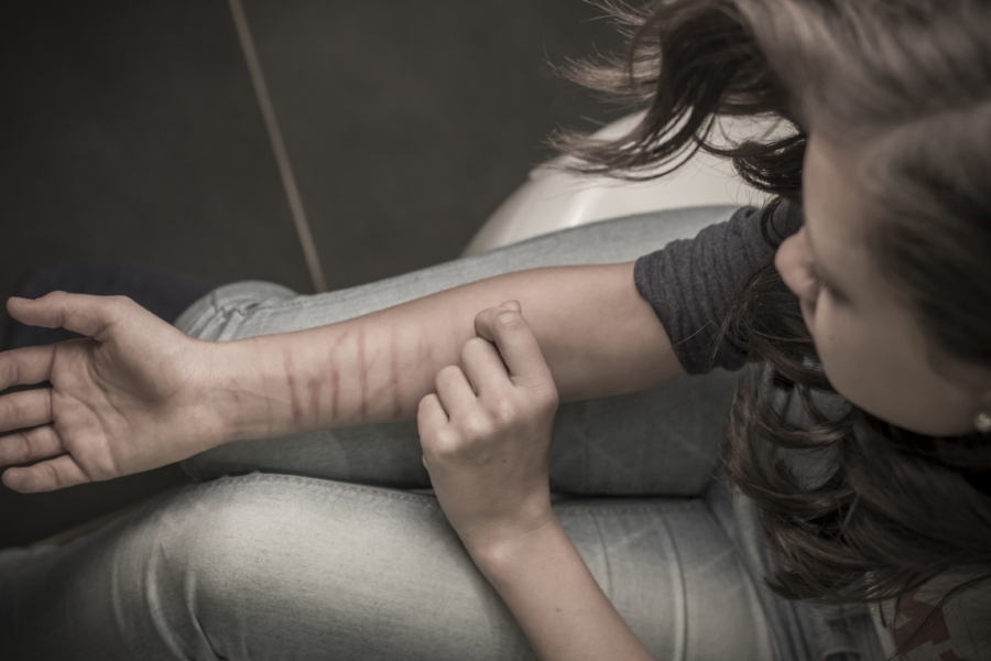 Il cutting e gli adolescenti: quando tagliarsi fa stare bene
